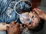 "اليونيسيف": "إسرائيل" قتلت 45 طفلاً بغزة في يومين