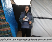 أطفال غزة يصرخون من الألم.. أمراض جلدية تفتك بأجسادهم الهزيلة