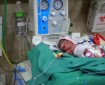 "يونيسيف": مستشفيات الأطفال وحديثي الولادة بغزة تفتقر لمعدات طبية