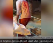 براءة غزة تحت الحصار.. مستشفيات تئن بين الدمار والموت