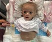 "أونروا": 66 ألف طفل بغزة يعانون من سوء تغذية خطير