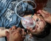 "اليونيسيف": "إسرائيل" قتلت 45 طفلاً بغزة في يومين