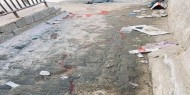 إصابتان خلال انفجار عرضي داخل منزل غرب غزة
