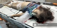 الأورومتوسطي: الاحتلال يتعمد قتل النساء والأطفال بمعدلات مروعة