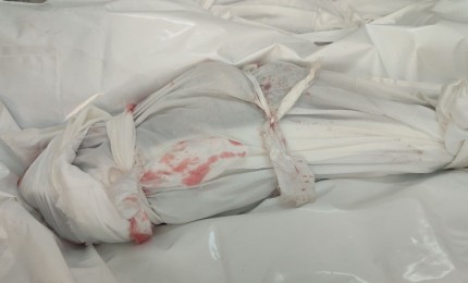 استشهاد طفل متأثرا بإصابته في مخيم البريج وسط قطاع غزة