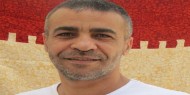 الأسير ناصر أبو حميد يجرى عملية إزالة ورم من الرئة اليسرى