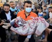 الصحة: ارتفاع عدد شهداء العدوان على غزة إلى 34183 شهيدا و 77143 مصابا