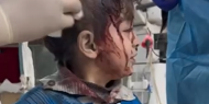 خاص بالفيديو | طفل مصاب في رفح ردا على مجازر الاحتلال: بخافش